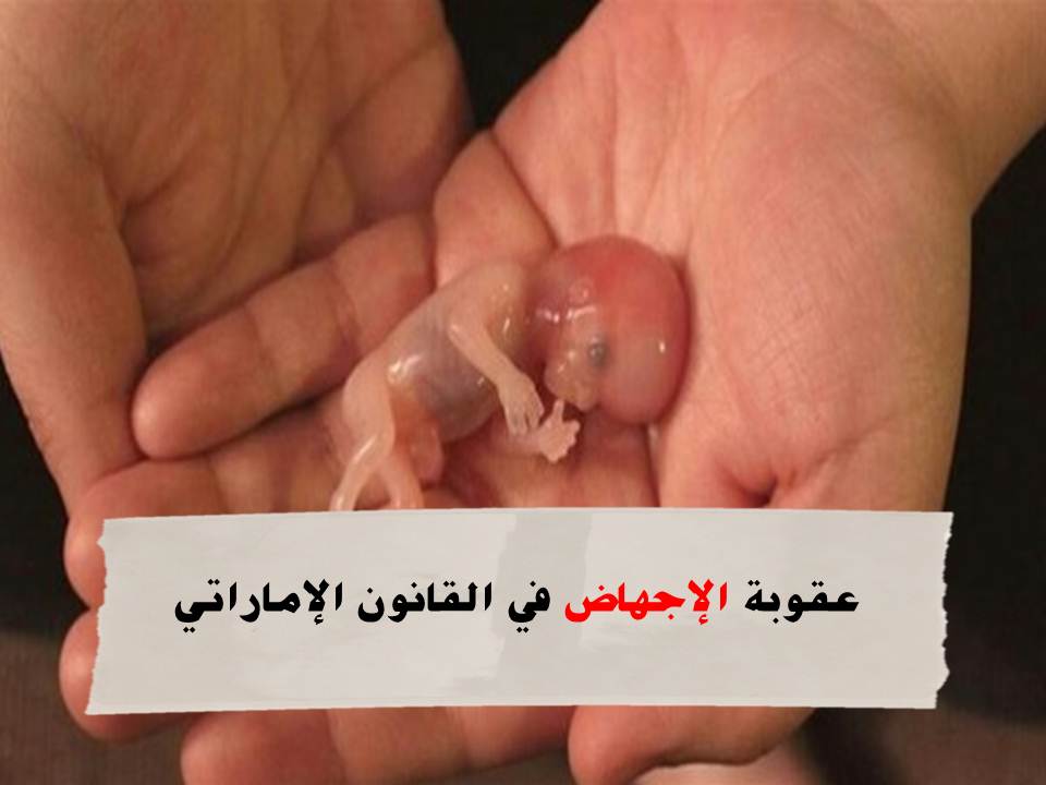 الإجهاض في القانون الإماراتي